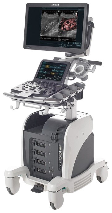 エコー「ARIETTA 650」（富士フイルム製）